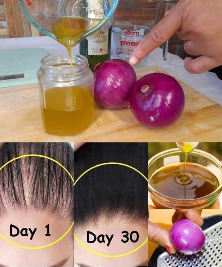 Onion Hair Oil for Hair Growth