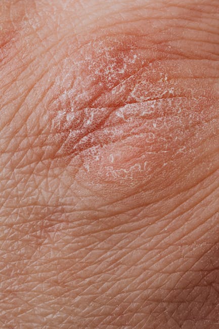 How Paleo Helps Manage Eczema and Skin Issues