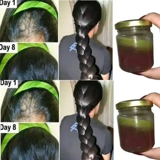 The Indian secret, ?? to grow hair at a rocket speed and treat baldness from the first week