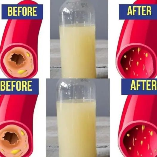 Only a Glass of This Juice will Remove Clogged Arteries And Control Blood Pressure