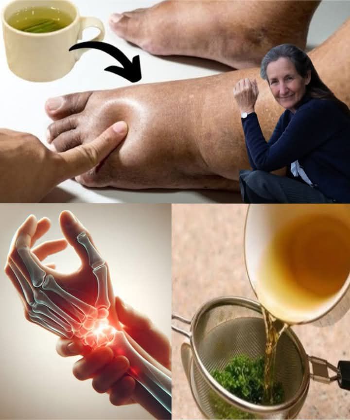 Say Goodbye to Swollen Legs, Ankles & Feet with This Natural