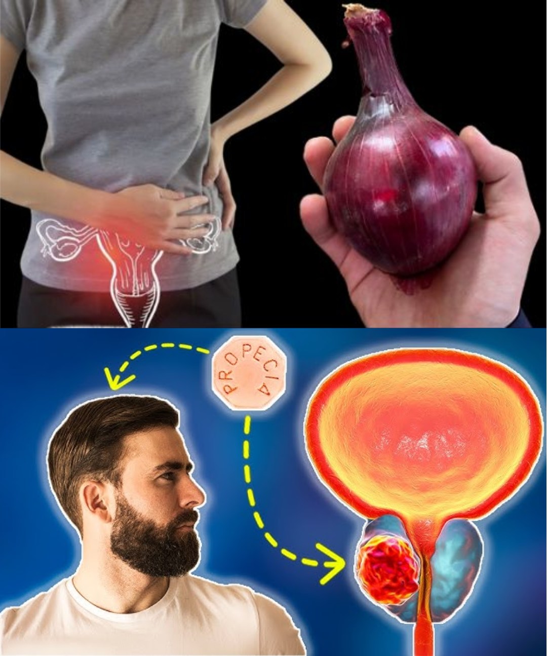 Onions: The Underrated Superfood Every Man Should Be Eating for Prostate Health