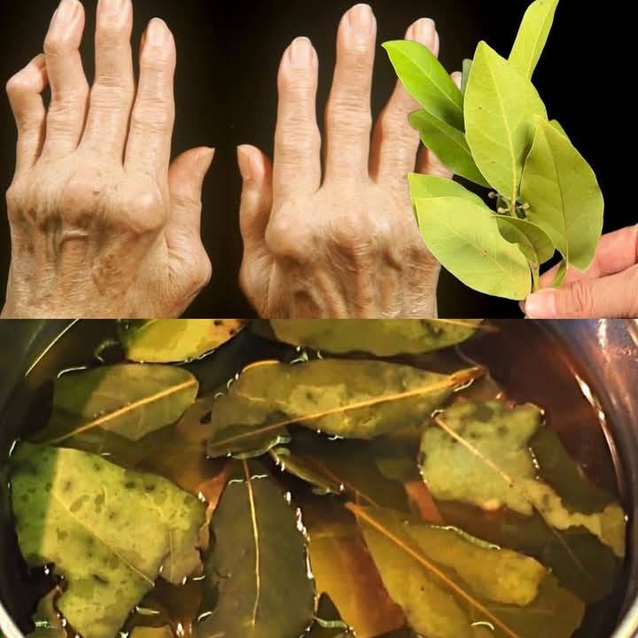 Apply bay leaves to the joints. You will run like a teenager in 1 week