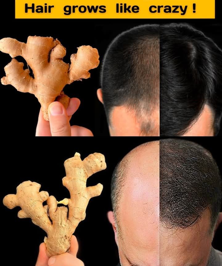 Hair grows like crazy, just like when I was young! Stop hair aging