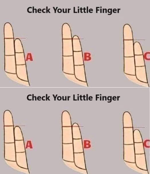 What Your Pinky Finger Reveals: When Ancient Palmistry Meets Modern Psychology
