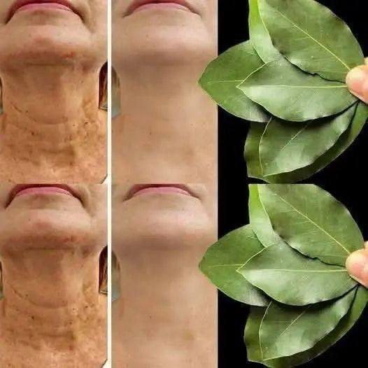 Bay leaf is 100000 times stronger than Botox. It erases all wrinkles even at the age of 70