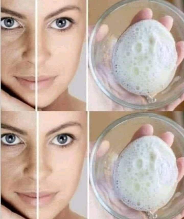 How to Use Baking Soda to Remove Spots, Wrinkles and Dark Circles from the Face