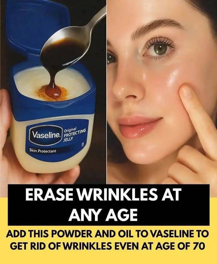 Vaseline’s Magic Recipe for Removing Wrinkles at Any Age – Even After the Age of Seventy!