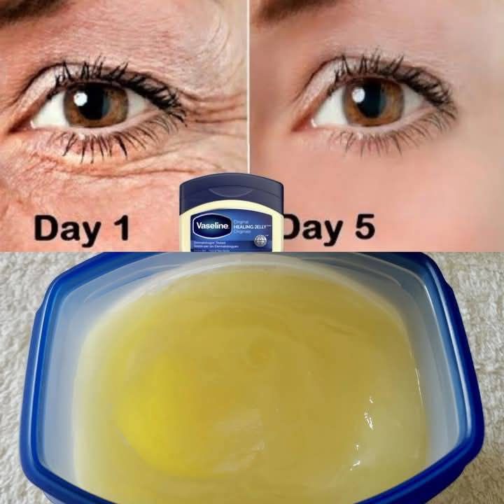 The power of Vaseline to remove wrinkles! You will look 20 years younger, the best Botox