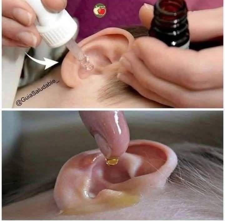Put 2 drops in your ear and you will hear like before. Recover your hearing