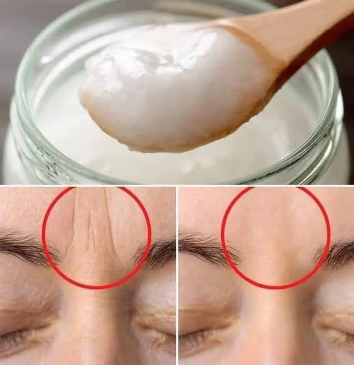 Natural Coconut Oil Wrinkle-Reducing Cream