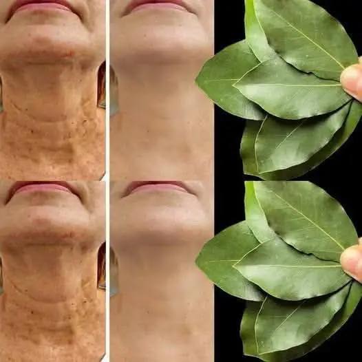 Bay Leaf: The Natural Wrinkle Eraser for Ageless Beauty!