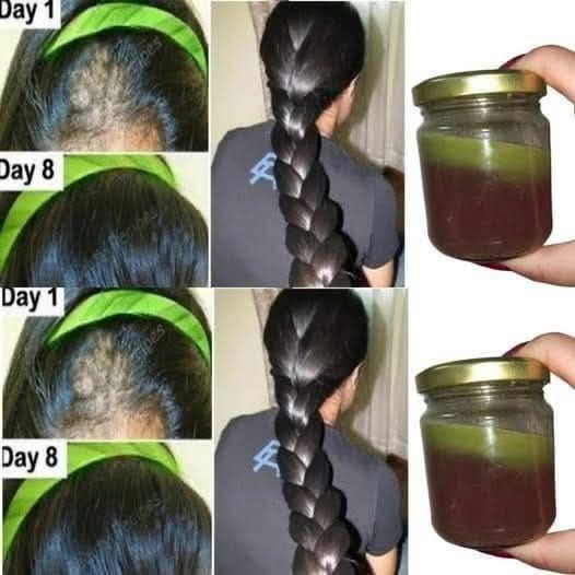 The Indian Secret: Using Cloves to Promote Rapid Hair Growth and Treat Baldness