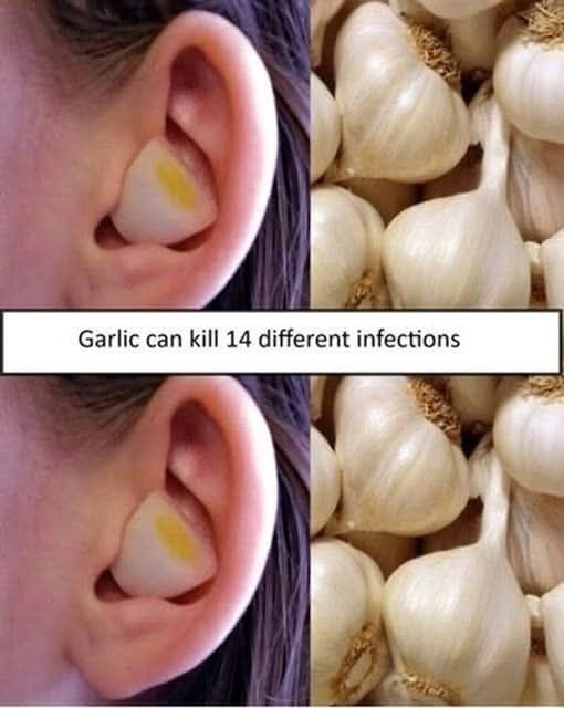 Garlic Can Kill 14 Different Infections – Here’s Why It’s Nature’s Most Powerful Medicine