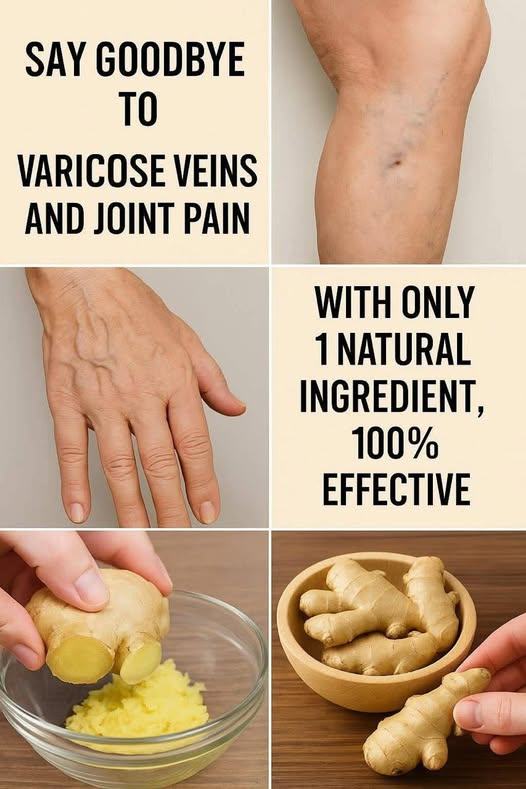 Say Goodbye to Varicose Veins and Joint Pain with Only 1 Natural Ingredient – 100% Effective